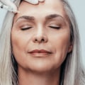 The Benefits of Dermal Fillers: A Comprehensive Guide
