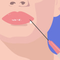 5 Danger Zones to Avoid When Injecting Dermal Fillers