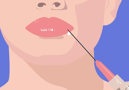 Everything You Need to Know About FDA-Approved Lip Fillers