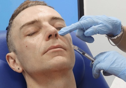 Where to Inject Cheek Fillers for a Youthful Look