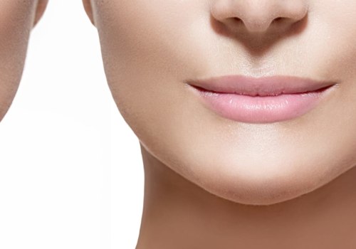 How Long Do Dermal Fillers Last? A Comprehensive Guide