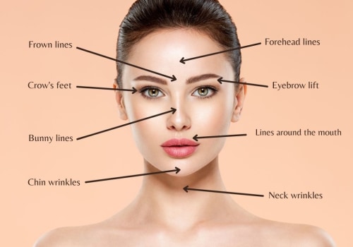 Dermal Fillers Explained